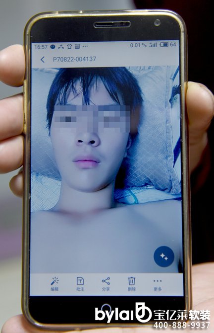 ܛ�b�^���ˣ���Ⱦ����(qi��ng)��(x��)��MRSA ��(ji��n)�(y��ng)17�q�������14��(�D)